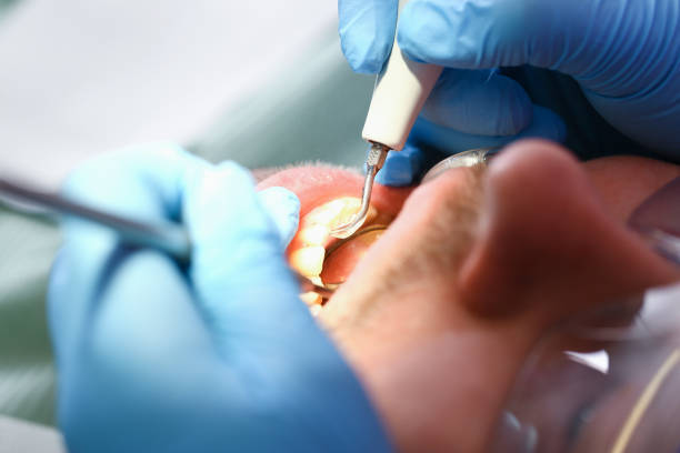 Best Emergency Dental Surgery in Rosendale, WI