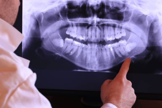 Best Emergency Root Canal Treatment in Rosendale, WI