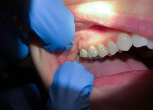 Best Emergency Broken Tooth Repair in Rosendale, WI